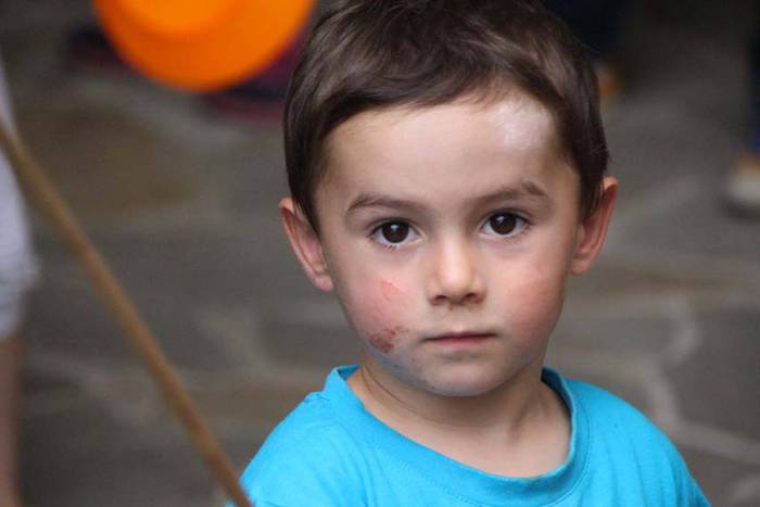 Umeak trapezisten modura ibili dira Larraulen 11 1438441177727