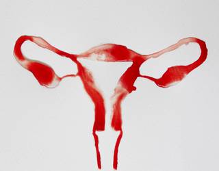 Ugal aparatu femeninoaz