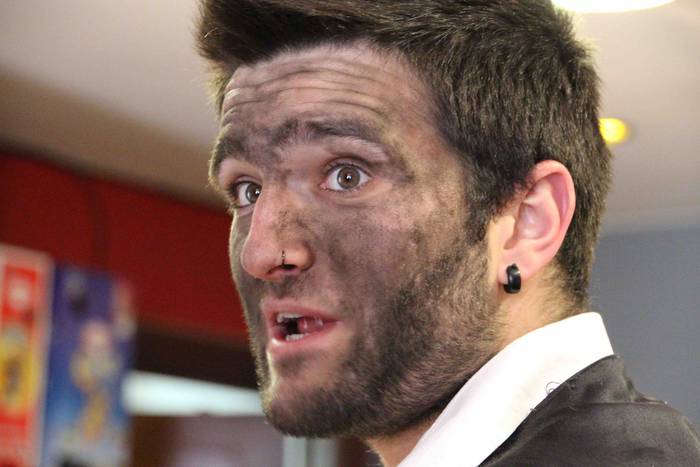 Lo zegoena, esnatu dute Abal 38 1551613775230